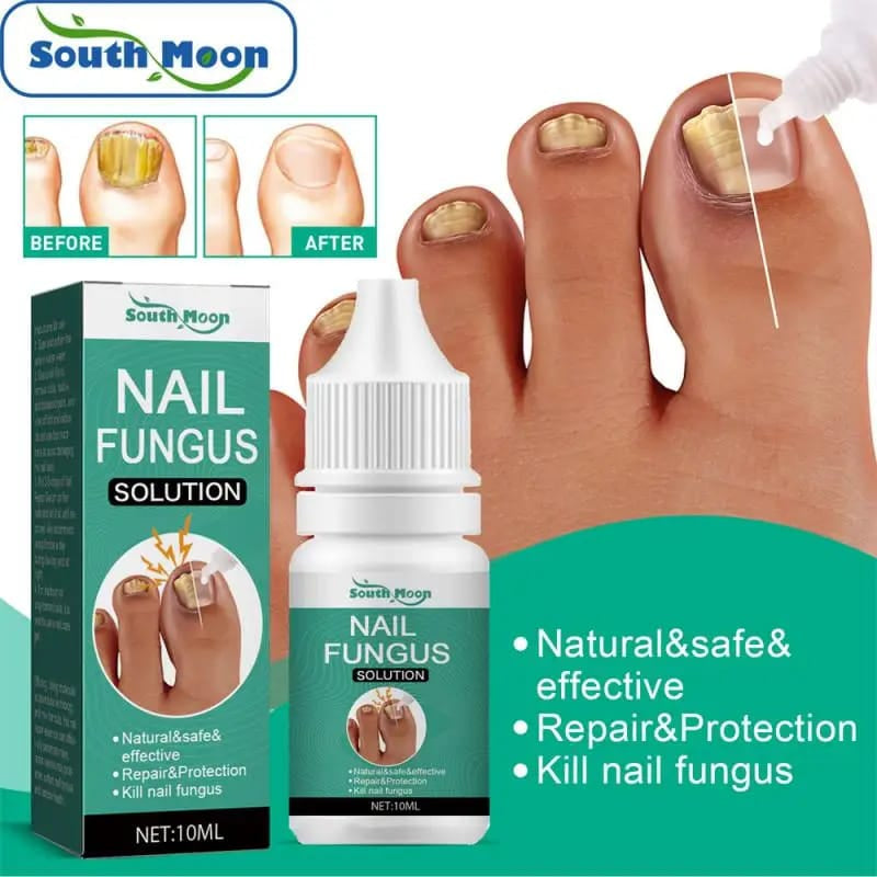 Fast Nail Fungus Treatment & Nail Repair Serum – Anti-Fungal Gel for Paronychia, Onychomycosis, Thick Nails, Nail Renewal & Strengthening Solution